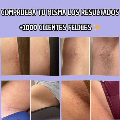 Depiladora Sin Dolor - Piel Suave al Instante - 50% DESCUENTO